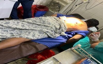 Un efectivo cae herido de bala en una emboscada cuando narcotraficantes iban a recuperar su cocaína en el Chapare