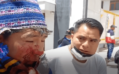 Zacarías Villca es el herido por impacto de granada de gas en medio de los enfrentamientos en Sucre