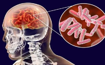 Cochabamba: muere segunda víctima por meningitis, esta vez es un hombre de 37 años